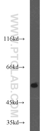 MMP20 Antibody in Western Blot (WB)