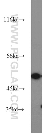 MMP20 Antibody in Western Blot (WB)