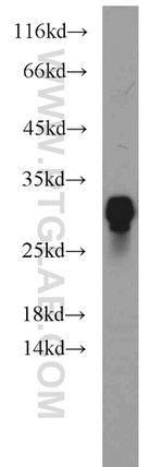 NPAS3 Antibody in Western Blot (WB)
