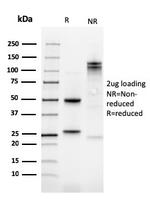 Kindlin-1/KIND1 Antibody in SDS-PAGE (SDS-PAGE)