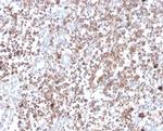 Protein Kinase C alpha/PRKCA Antibody in Immunohistochemistry (Paraffin) (IHC (P))