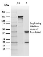 Protein Kinase C iota/lambda/PRKCI Antibody in Immunohistochemistry (Paraffin) (IHC (P))