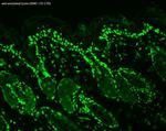 Acetylated Lysine Antibody in Immunohistochemistry (Paraffin) (IHC (P))