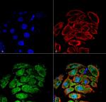 Glucose transporter 2 Antibody in Immunocytochemistry (ICC/IF)