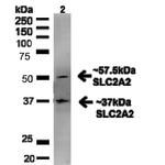 Glucose transporter 2 Antibody in Western Blot (WB)