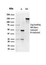 Resistin (RETN) Antibody in SDS-PAGE (SDS-PAGE)