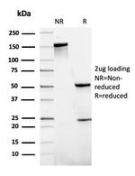 SLAMF7/CS1/CD319 Antibody in SDS-PAGE (SDS-PAGE)