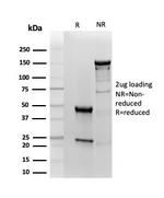 RBP4/Retinol Binding Protein 4 Antibody in SDS-PAGE (SDS-PAGE)