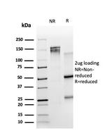 TRIM27 Antibody in SDS-PAGE (SDS-PAGE)