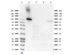 Aldh1l1 Antibody in Western Blot (WB)