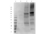Aldh1l1 Antibody in Western Blot (WB)