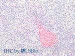 Collagen Type III Antibody in Immunohistochemistry (Paraffin) (IHC (P))