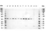 Phospho-SMAD3 (Ser423, Ser425) Antibody in Western Blot (WB)