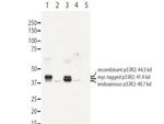 RRM2B p53R2 Antibody in Western Blot (WB)
