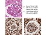 Cytochrome P450 Antibody in Immunohistochemistry (IHC)