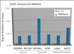 H3R8me2s Antibody in ChIP Assay (ChIP)