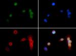 H3K18me2 Antibody in Immunocytochemistry (ICC/IF)