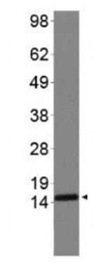 H3R2me2sK4me2 Antibody in Western Blot (WB)