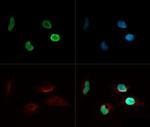 H4K8ac Antibody in Immunocytochemistry (ICC/IF)