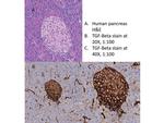 TGF beta Receptor 1 Antibody in Immunohistochemistry (IHC)