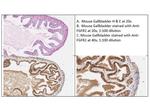 FGFR2 Antibody in Immunohistochemistry (IHC)