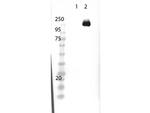 Cas 9 Antibody in Western Blot (WB)