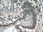 KEAP1 Antibody in Immunohistochemistry (Paraffin) (IHC (P))