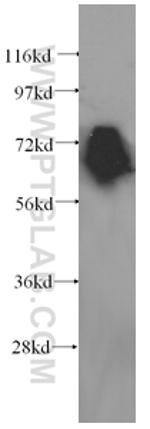 KEAP1 Antibody in Western Blot (WB)