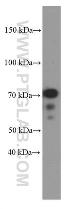 KEAP1 Antibody in Western Blot (WB)