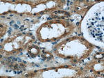 KEAP1 Antibody in Immunohistochemistry (Paraffin) (IHC (P))