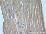 KEAP1 Antibody in Immunohistochemistry (Paraffin) (IHC (P))