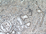 KEAP1 Antibody in Immunohistochemistry (Paraffin) (IHC (P))