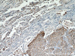 MAGEA3 Antibody in Immunohistochemistry (Paraffin) (IHC (P))