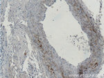 MGP Antibody in Immunohistochemistry (Paraffin) (IHC (P))