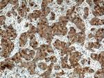 RRM1 Antibody in Immunohistochemistry (Paraffin) (IHC (P))