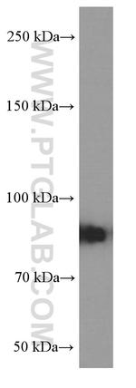 RRM1 Antibody in Western Blot (WB)