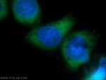 RRM1 Antibody in Immunocytochemistry (ICC/IF)