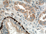 RRM1 Antibody in Immunohistochemistry (Paraffin) (IHC (P))