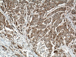 RRM1 Antibody in Immunohistochemistry (Paraffin) (IHC (P))