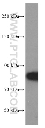 RRM1 Antibody in Western Blot (WB)