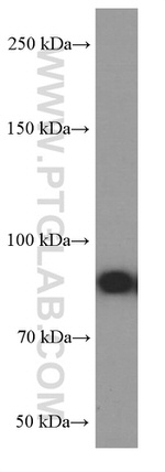 RRM1 Antibody in Western Blot (WB)