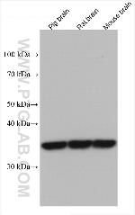 SULT1A1 Antibody in Western Blot (WB)
