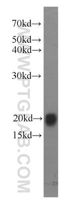 RAC2 Antibody in Western Blot (WB)