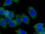 GDI2 Antibody in Immunocytochemistry (ICC/IF)