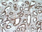 GDI2 Antibody in Immunohistochemistry (Paraffin) (IHC (P))