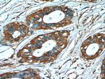 GDI2 Antibody in Immunohistochemistry (Paraffin) (IHC (P))