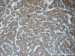 GDI2 Antibody in Immunohistochemistry (Paraffin) (IHC (P))