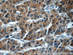 GDI2 Antibody in Immunohistochemistry (Paraffin) (IHC (P))