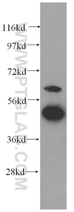 GDI2 Antibody in Western Blot (WB)