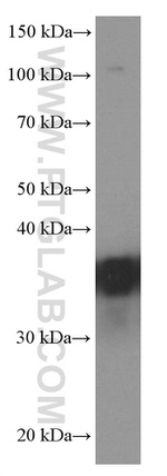 EEF1D Antibody in Western Blot (WB)